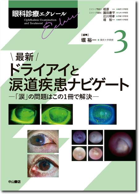m3電子書籍 | 眼科専門医への最短コース 眼科専門医認定試験問題集 第
