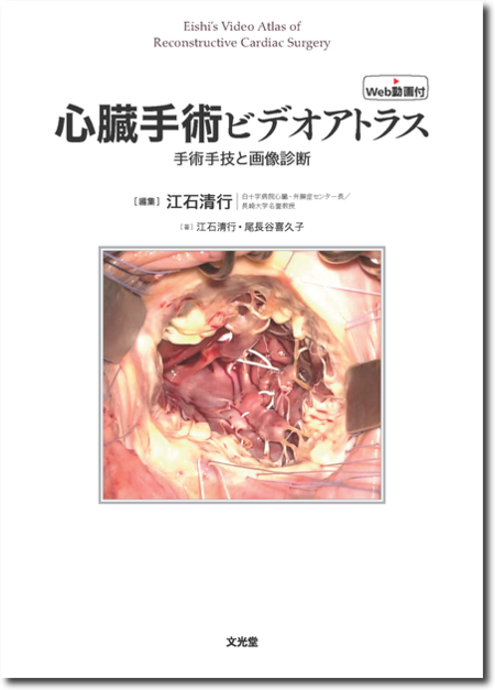 裁断済 心臓血管外科手術エクセレンス 2 弁膜症の手術 裁断済み 弁膜症