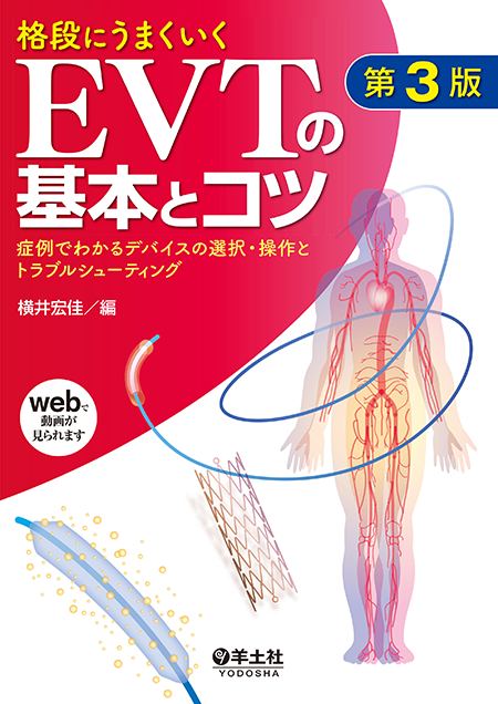 m3電子書籍 | ステントグラフト内挿術マニュアル 腹部編