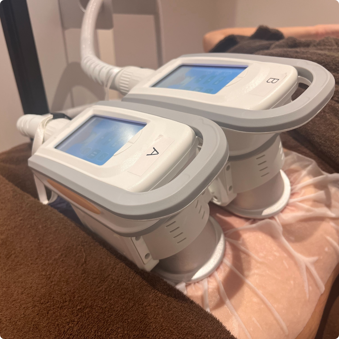 脂肪冷却痩身｜脱毛・ニキビ治療・ダイエットのイデア美容皮膚科