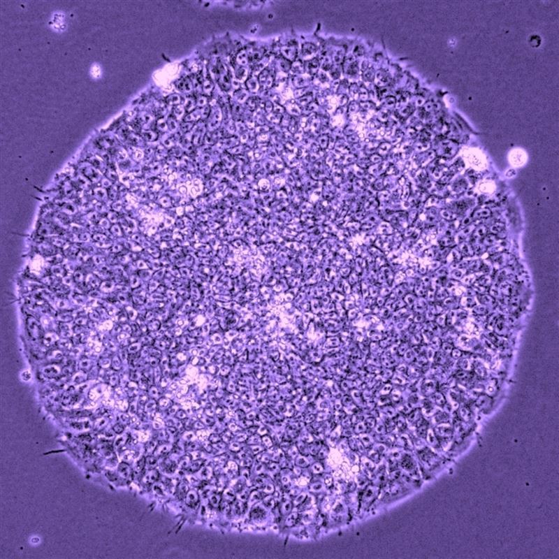 移植後の拒絶反応のリスクが少ない「iPS細胞」誕生へ｜ニュースイッチ