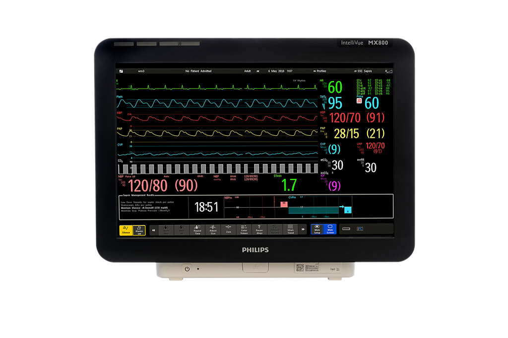 Philips - IntelliVue MX800 Bedside patient monitor - Philips
