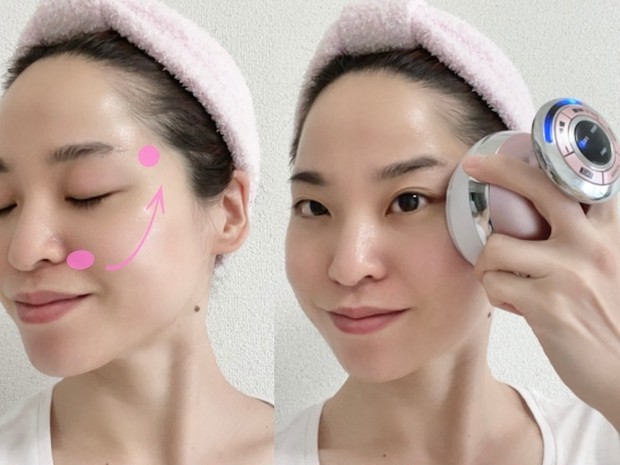 ビフォーアフター公開】30代からのたるみ・リフトアップに効果的な美顔