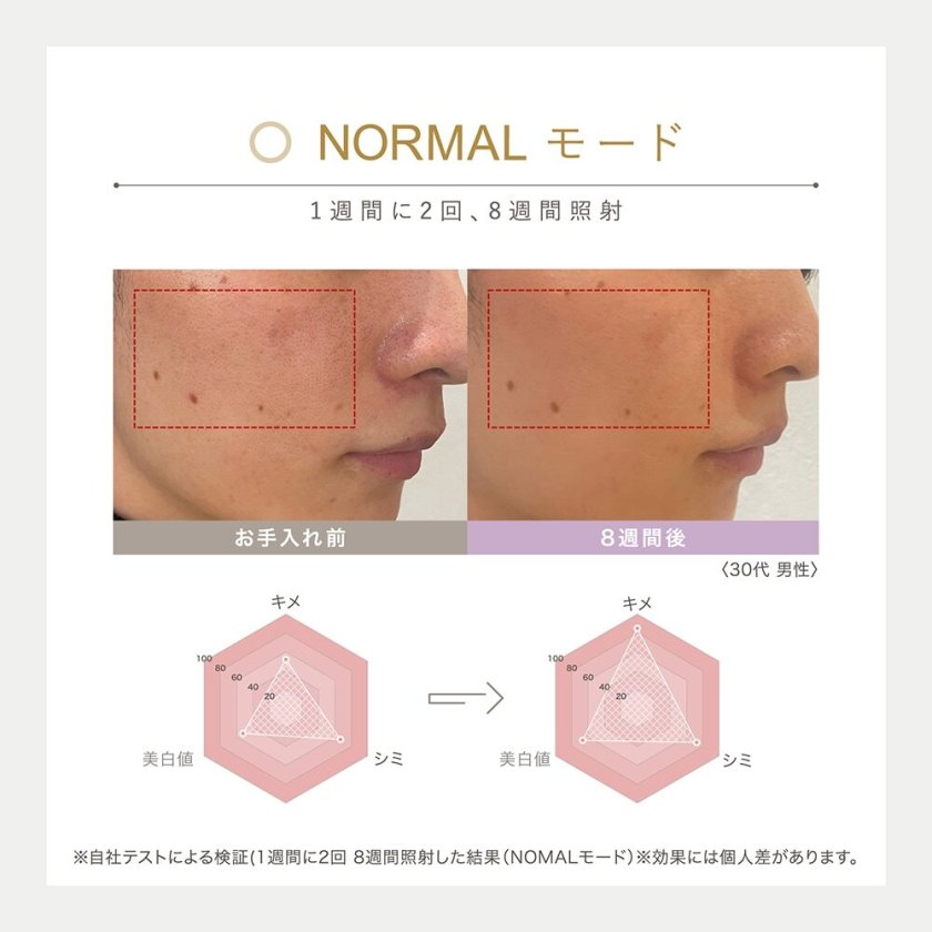 LINKAスノーフラッシュ DPL/NIR 光美容器 美顔器 ハリ ツヤ