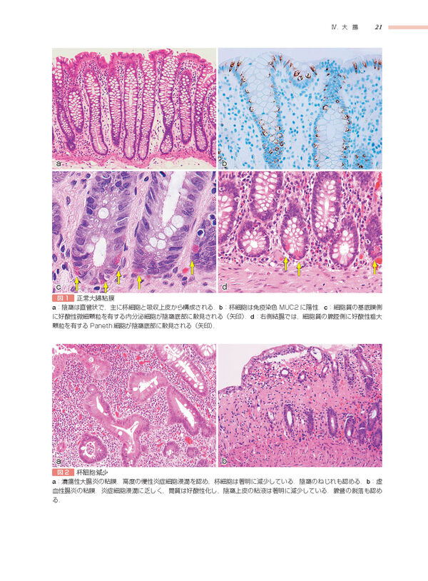 消化管 (非腫瘍性疾患病理アトラス) 九嶋 亮治(編) - 文光堂 | 版元