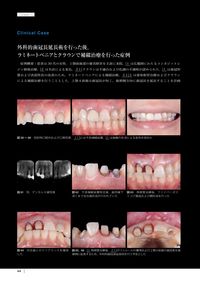 The Tooth Preparation 岩田 淳(著) - 医歯薬出版 | 版元ドットコム