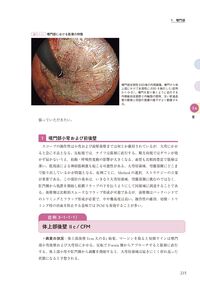 新版ESDアトラス 総論・食道・胃 編［Web動画付］ 豊永 高史(著