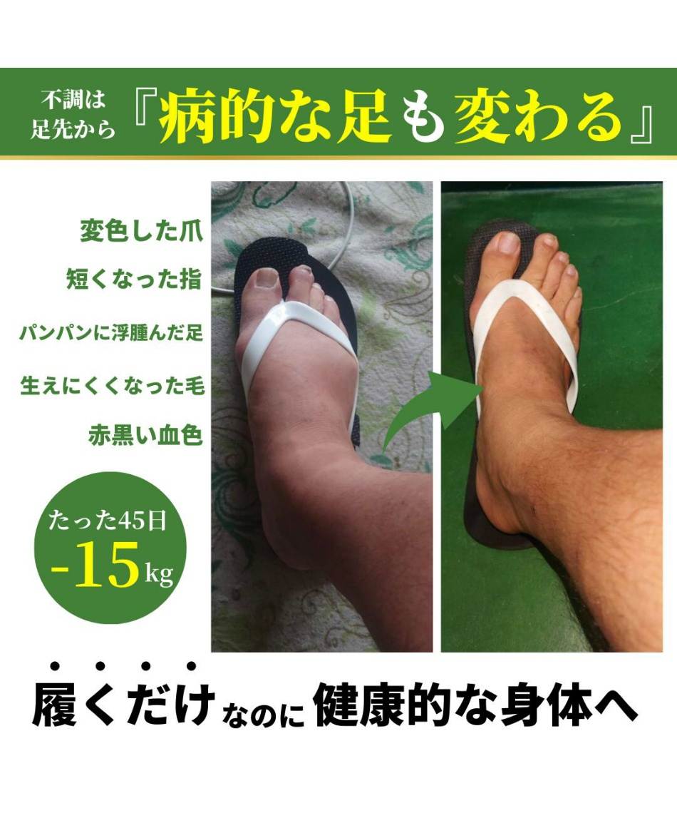 ラクバキ(Racbaki) ダイエットサンダル -5kg サンダル -5kg ｻﾝﾀﾞﾙ