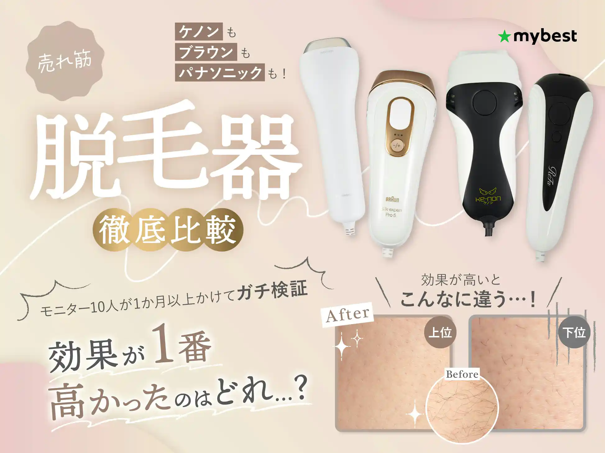 ケノン家庭用脱毛器 Amazon | エムテック ケノン KE-NON 光美容器 日本