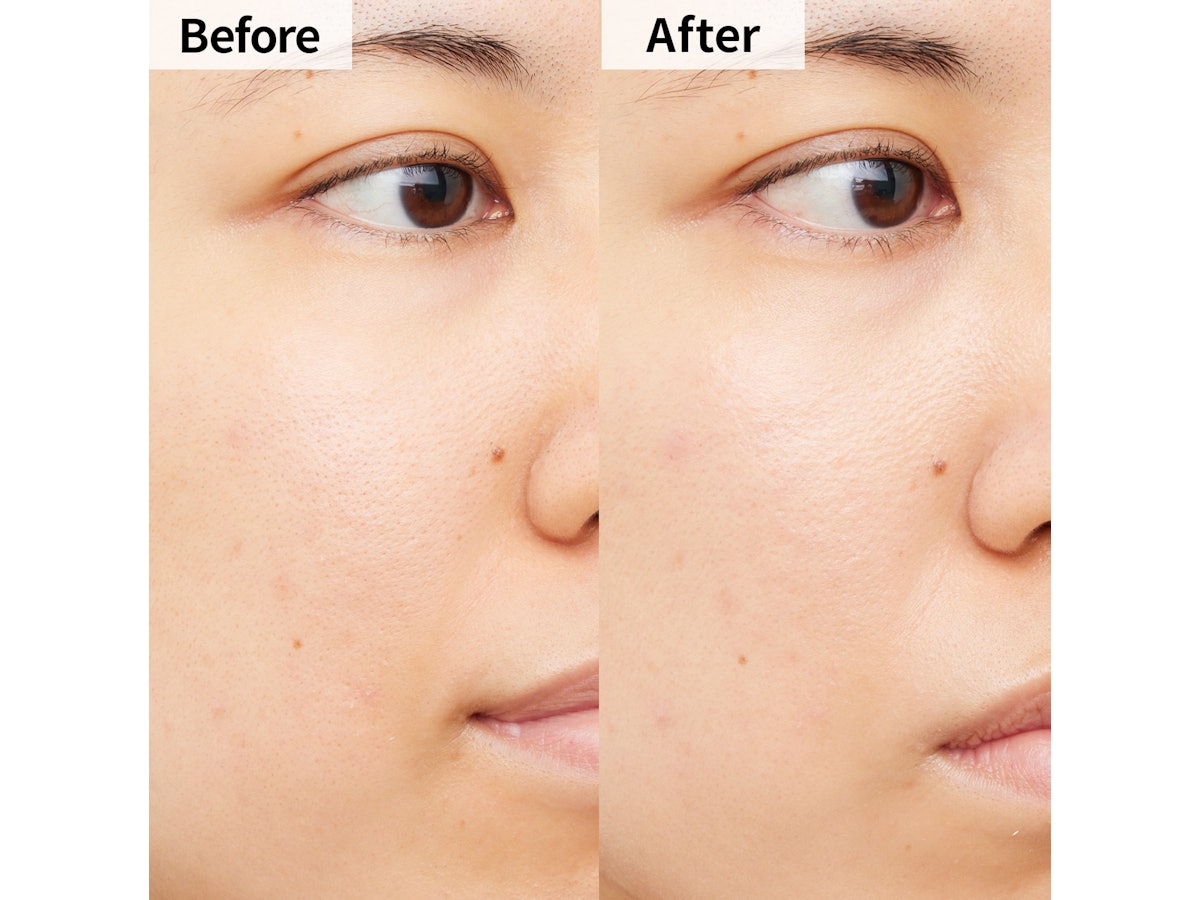 山野愛子どろんこ美容 シドナス Kプラス ウォーターファンデーションを