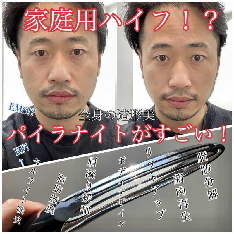 マツコの知らない世界でも紹介】まるでハイフ？全身の造形美を叶える