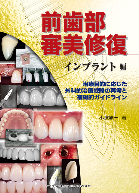 前歯部審美修復 インプラント編 - クインテッセンス出版