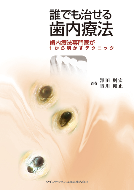 前歯部審美修復 天然歯編 - クインテッセンス出版