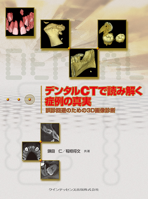 歯科用コーンビームCT徹底活用ガイド - クインテッセンス出版