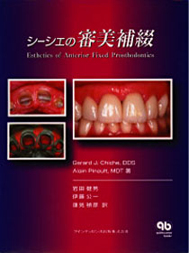 シーシェの 審美補綴 - クインテッセンス出版
