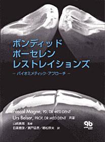ボンディッド ポーセレン レストレイションズ - クインテッセンス出版