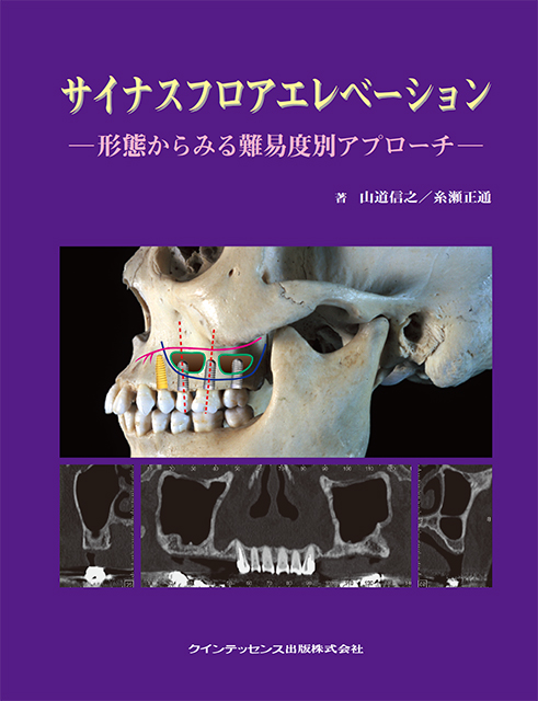 サイナスフロアエレベーション - クインテッセンス出版