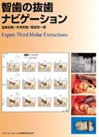 智歯の抜歯ナビゲーション - クインテッセンス出版