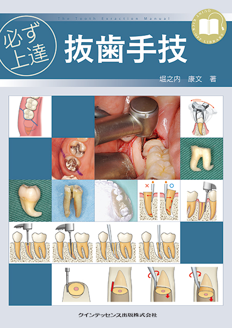 必ず上達シリーズの書籍 - クインテッセンス出版