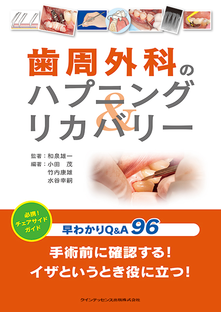 歯周外科のハプニング＆リカバリー - クインテッセンス出版