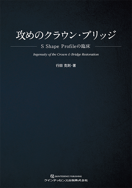 PR】「1（シングル）リテーナーオールセラミック接着ブリッジ」を臨床