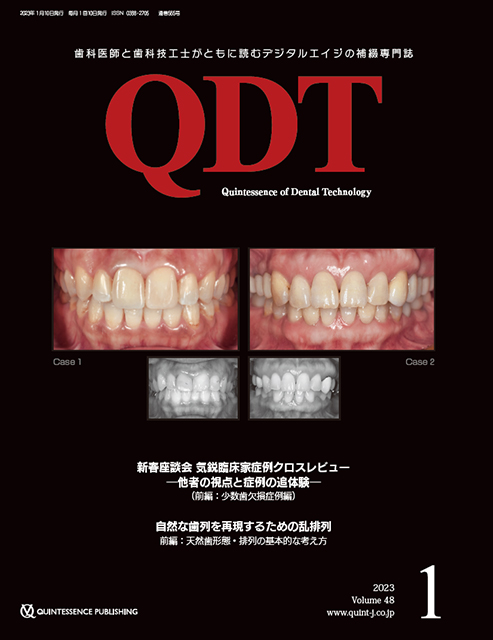 ペリオドントロジー&ペリオドンティクス 下巻 - クインテッセンス出版