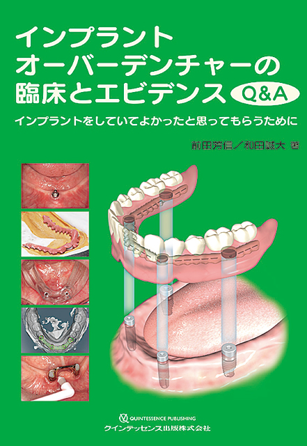 ITI Treatment Guide Volume 9 - クインテッセンス出版