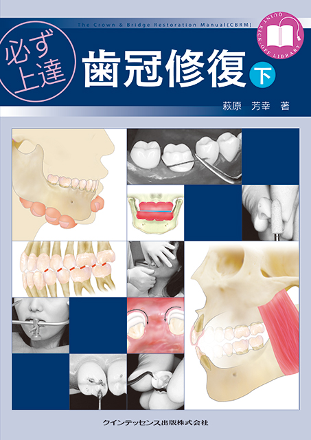必ず上達 歯冠修復（上） - クインテッセンス出版
