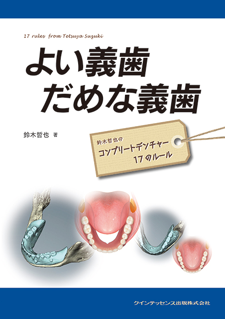 1からわかるコンポジットレジン修復 - クインテッセンス出版