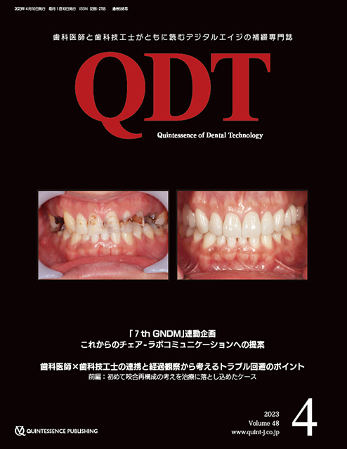 QDT 2023年6月号 - クインテッセンス出版