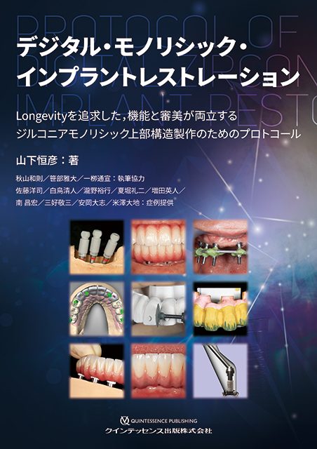 デジタル・モノリシック・インプラントレストレーション