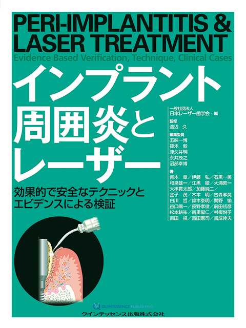 インプラント周囲炎とレーザー - クインテッセンス出版
