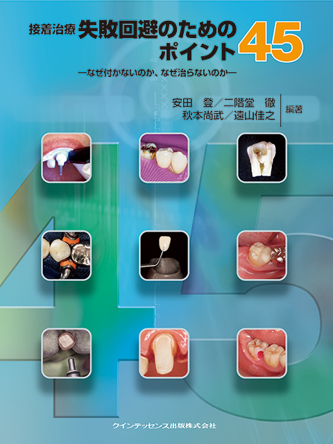 サイナスフロアエレベーション - クインテッセンス出版