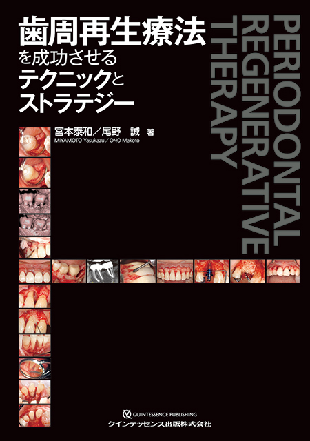 図解！ 遅延型吸収性膜を用いた 安全安心GBR - クインテッセンス出版