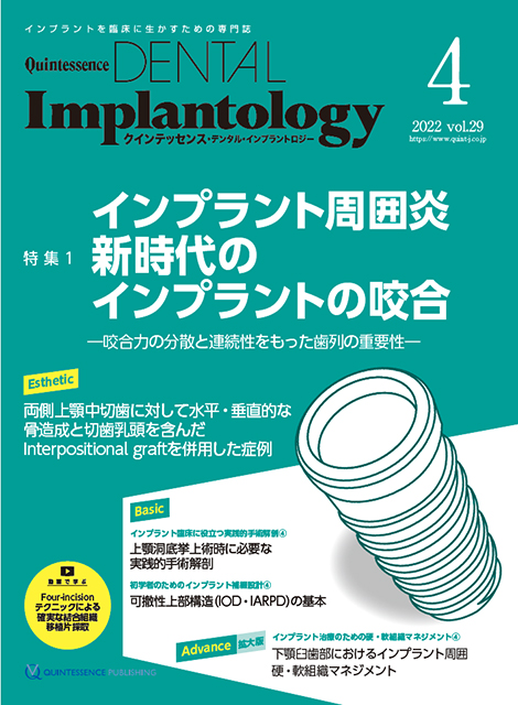 Quintessence DENTAL Implantology 2022年No.6 - クインテッセンス出版