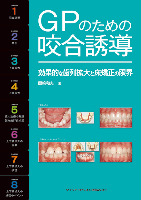 GPのための咬合誘導 - クインテッセンス出版