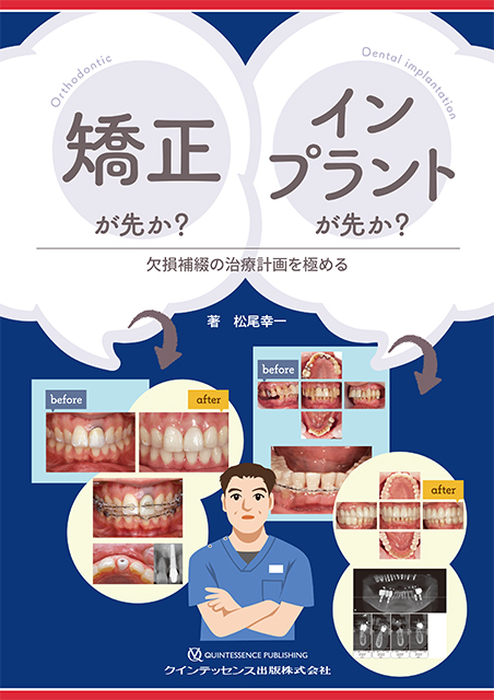 矯正が先か？ インプラントが先か？ - クインテッセンス出版