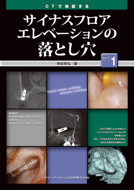 CTで検証する サイナスフロアエレベーションの落とし穴（CTで検証する