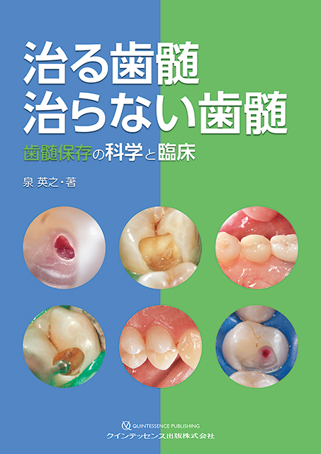 治る歯髄 治らない歯髄 - クインテッセンス出版
