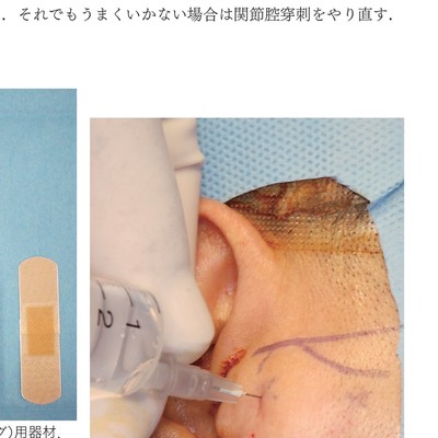 イラストでみる口腔外科手術 第3巻