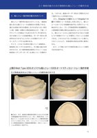 GDS 総義歯の真髄 4/6