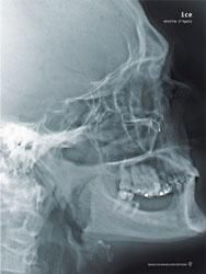 Antoine D'agata: Ice - BOOK OF DAYS ONLINE SHOP