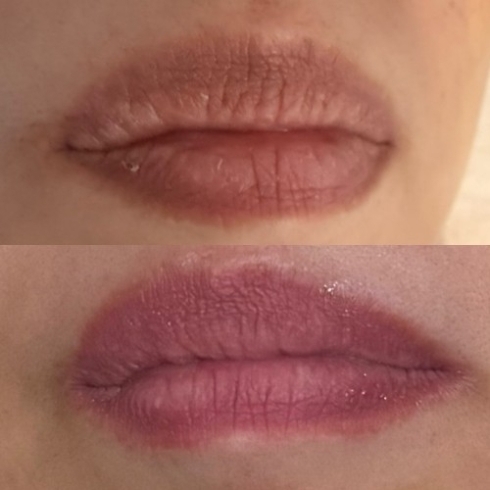 Roma pinkリップで叶える！唇のうるおい・血色感ビフォーアフター紹介