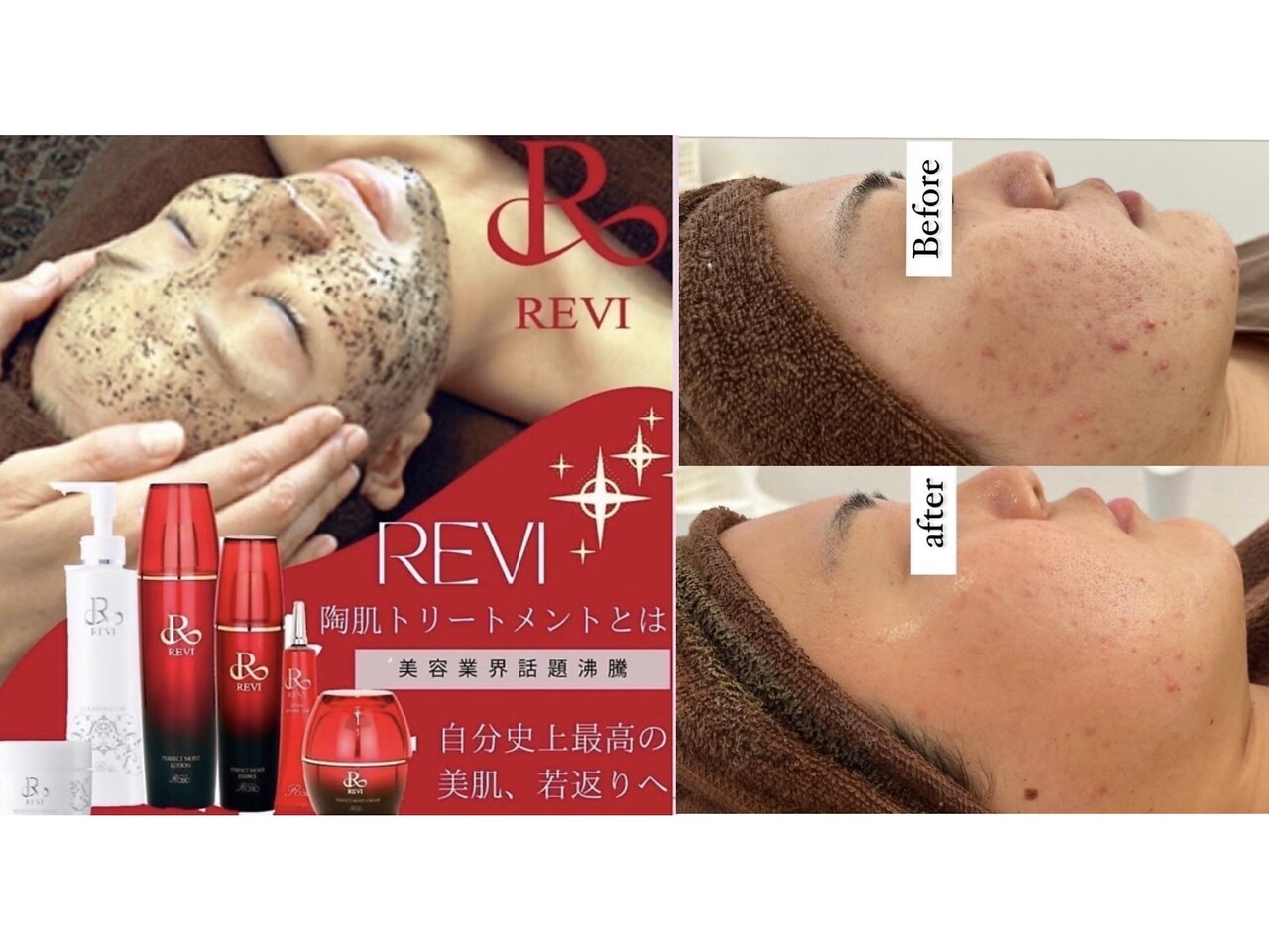 ルヴィ 浦添店(REVI)｜ホットペッパービューティー