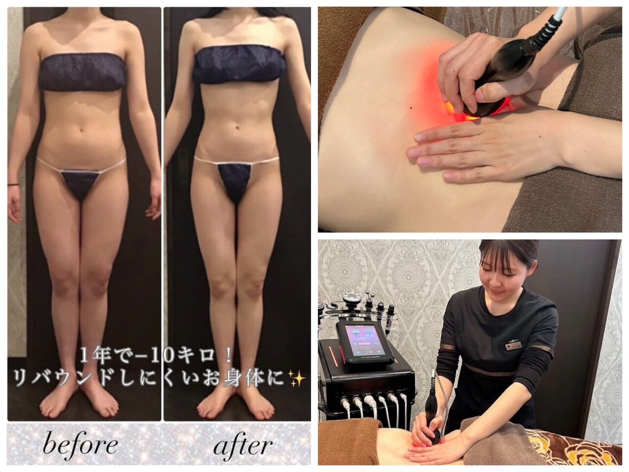 メディカルエステサロン ローズ 鯖江店(ROSE)｜ホットペッパービューティー