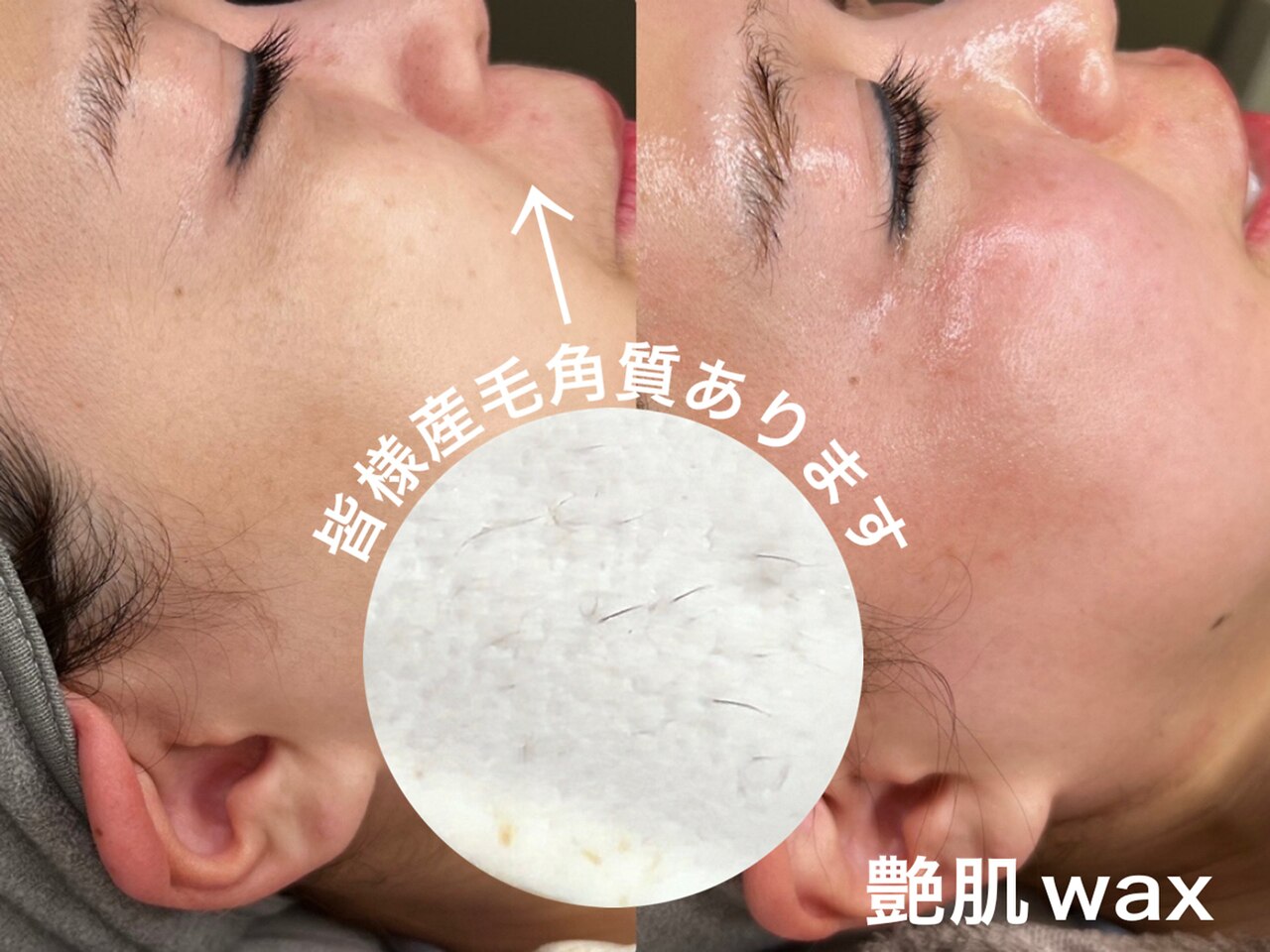 メームプラス(meme+)｜ホットペッパービューティー