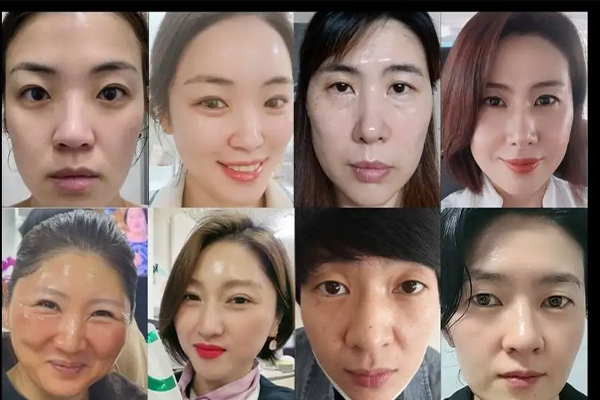 インセルダム日本公式代理店（INCELLDERM） ICD