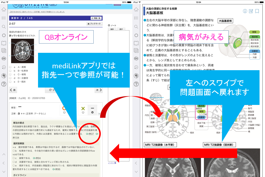 病気がみえる』や『レビューブック』の図表をフル活用！｜本当にコスパ