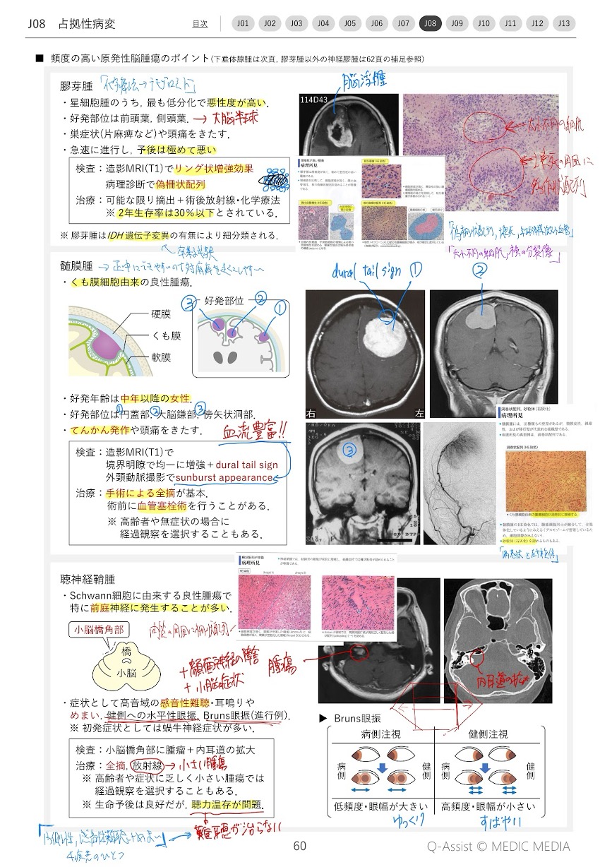 第118回医師国試【体験記】病みえで知識を定着させる方法！| INFORMA