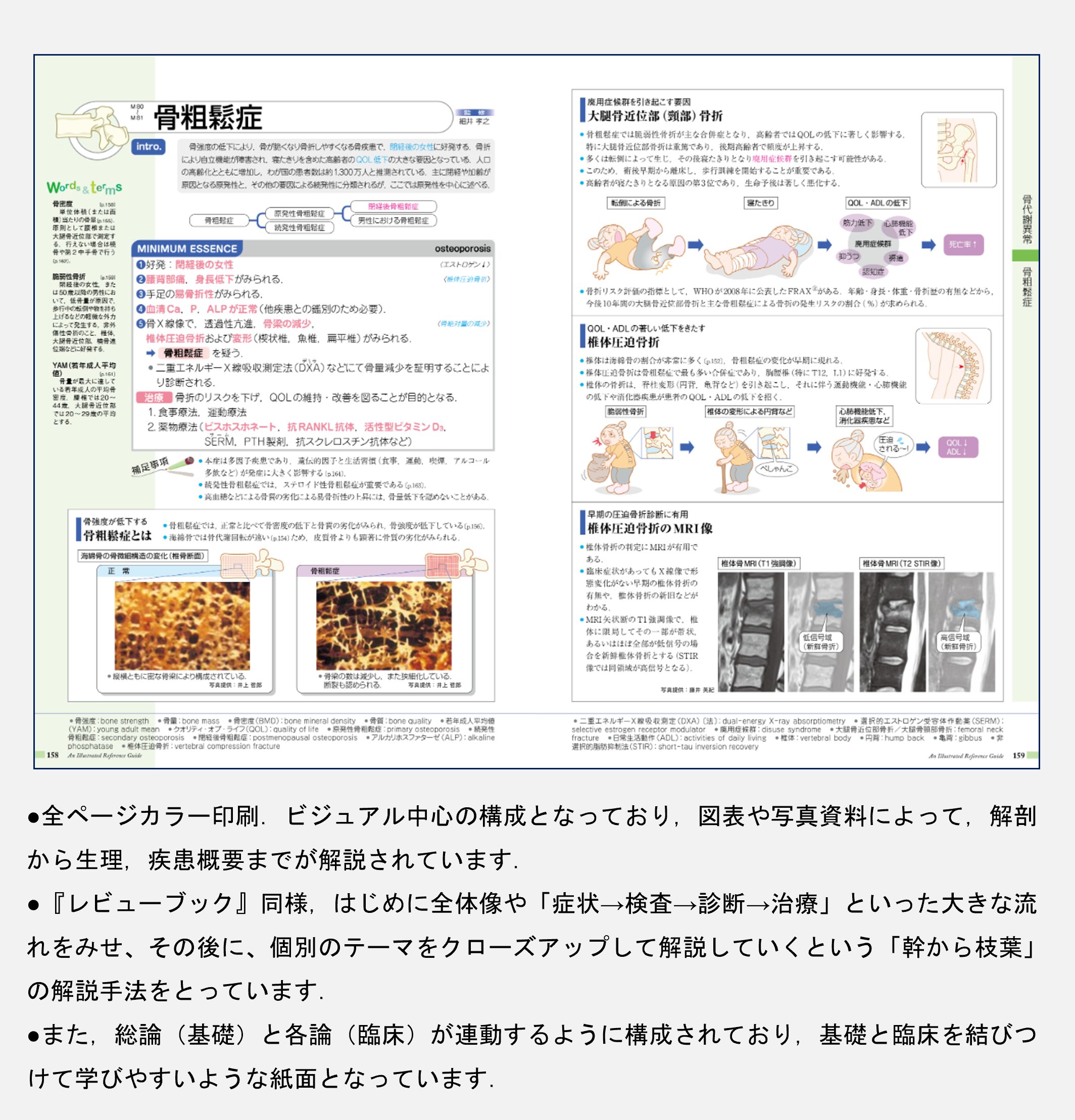 ニガテ克服】『レビューブック』と『病気がみえる』を上手に併用！効率